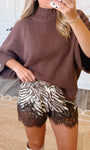 Zebra Lace Trim Shorts